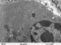 Clara cell lung - TEM--mediawiki PD Louisa Howard.jpg
